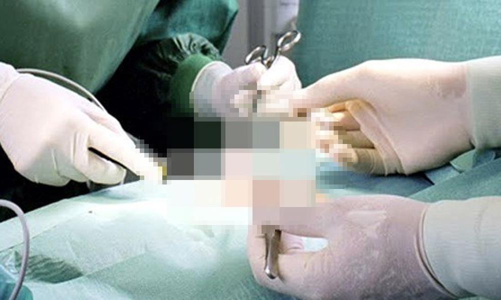 Bố vợ gãy 'của quý' khi đi chơi cùng con rể