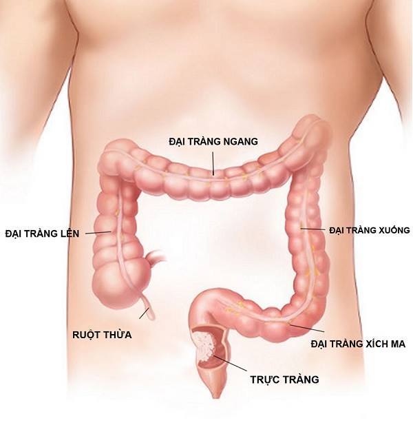 ca bệnh hy hữu,bao cao su,chuyện phòng the,thủ dâm