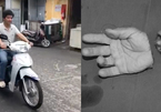 Lái xe máy vù vù sau 3 tháng bị đứt lìa bàn tay