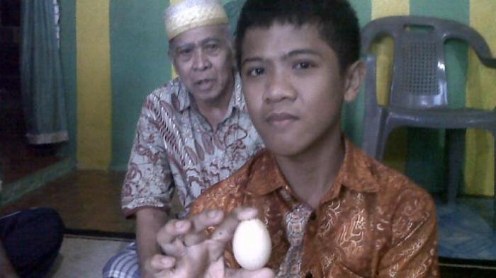 Sự thật về cậu bé biết đẻ trứng tại Indonesia