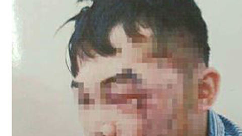 Cho bạn vay tiền xây nhà, cưới vợ, đi đòi bị bạn chém trọng thương