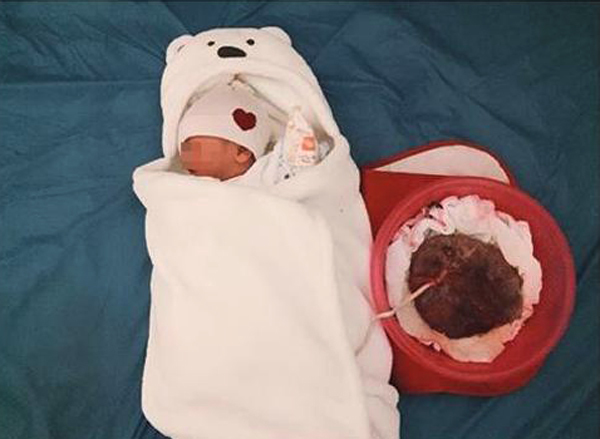 Tự đẻ tại nhà, bà mẹ không cắt rốn cho con, đặt con cạnh bánh nhau 6 ngày