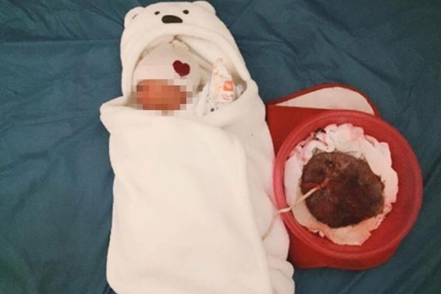 Tự sinh tại nhà theo trào lưu ‘thuận tự nhiên’, 2 mẹ con tử vong