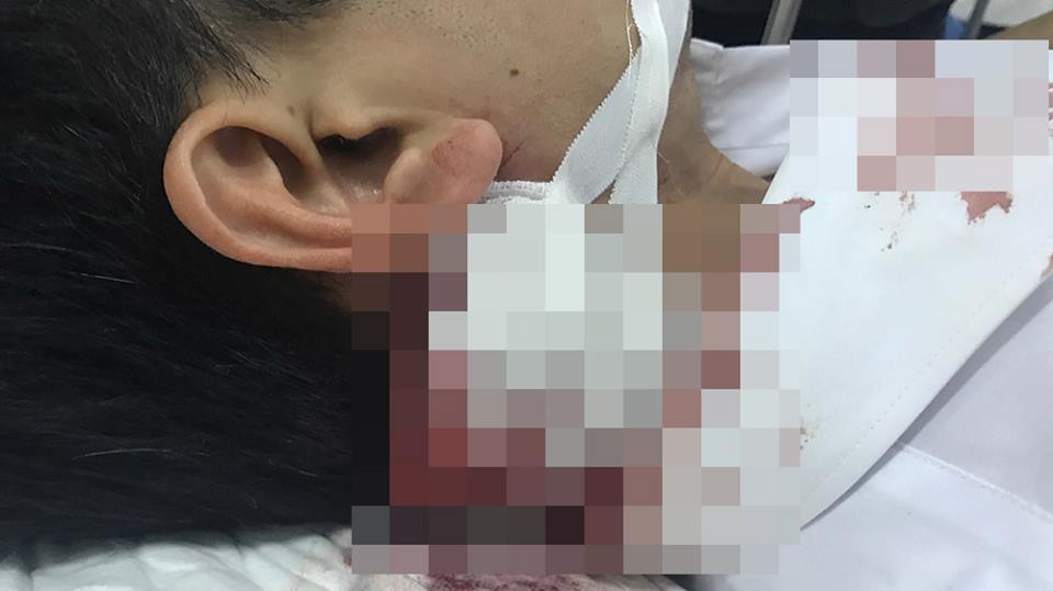 Thiếu tá bị đâm trọng thương trước trụ sở công an quận