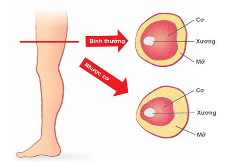 3 cách giúp chậm chứng 'nhược cơ' tuổi già