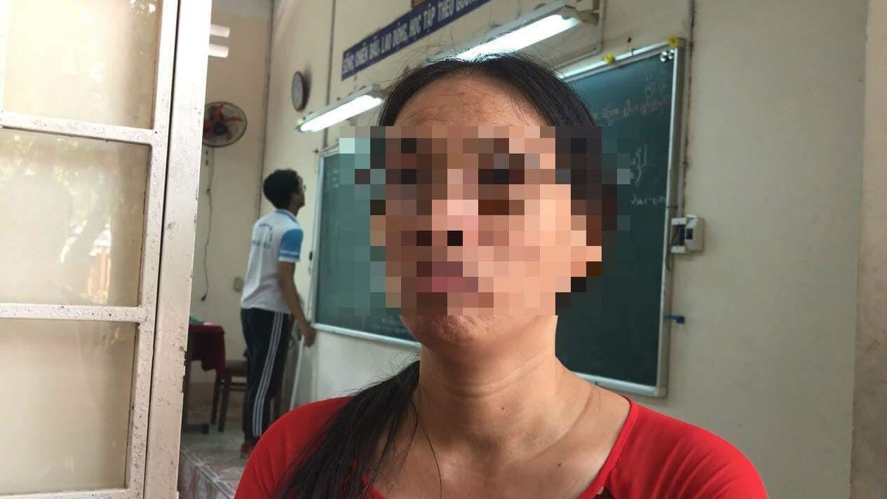 Cô giáo lần đầu lên tiếng việc