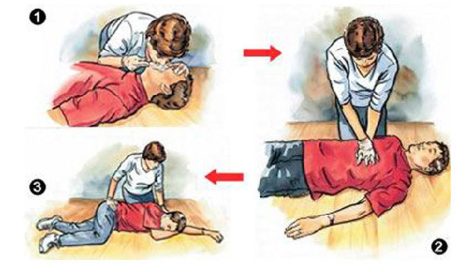 Những sai lầm thường mắc phải khi sơ cứu