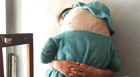Vụ bé gái 11 tuổi câm điếc bị xe ôm hiếp dâm: Tìm thấy ADN nghi phạm trong vùng kín của bé gái