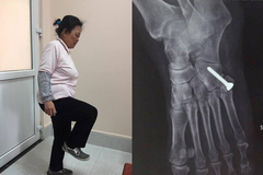 Khó tin, một phụ nữ Hà Nội uống hàng chục kg thuốc giảm đau