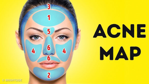 Bắt bệnh khi xem vị trí mụn trên mặt