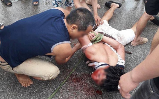 Người đàn ông bị đánh bầm dập vì nghi bắt cóc trẻ em ở Hưng Yên