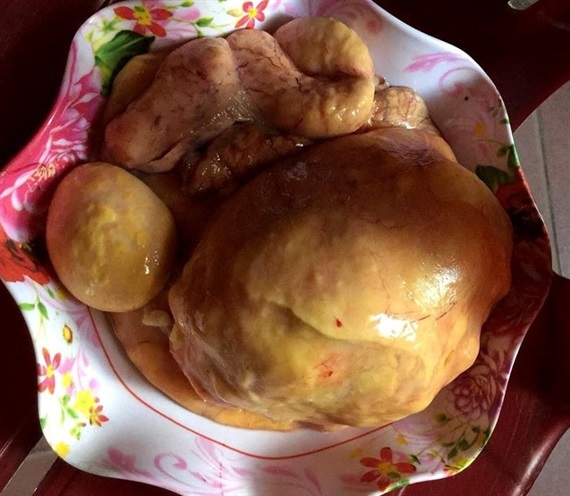 Làm thịt gà, phát hiện dị vật nghi là 'kê bảo'