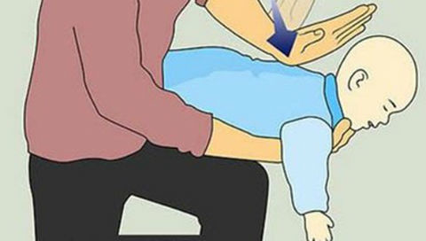 Thủ thuật heimlich