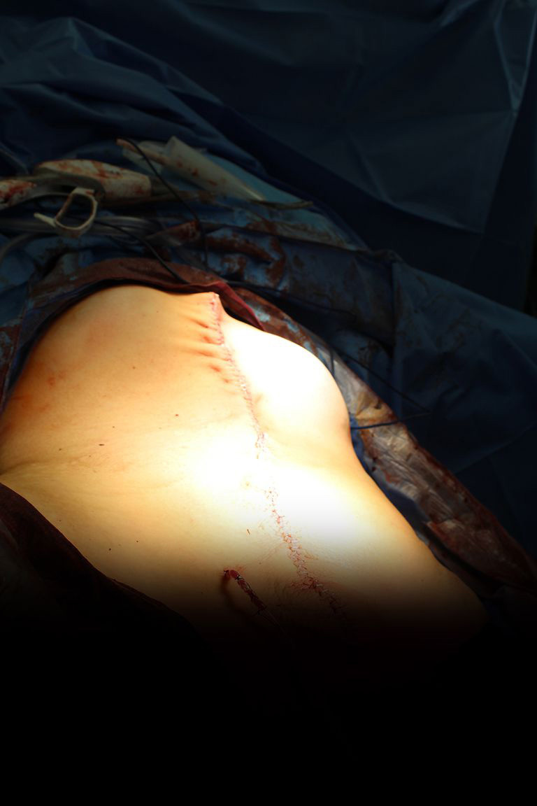 khối u,u nang buồng trứng,tử cung