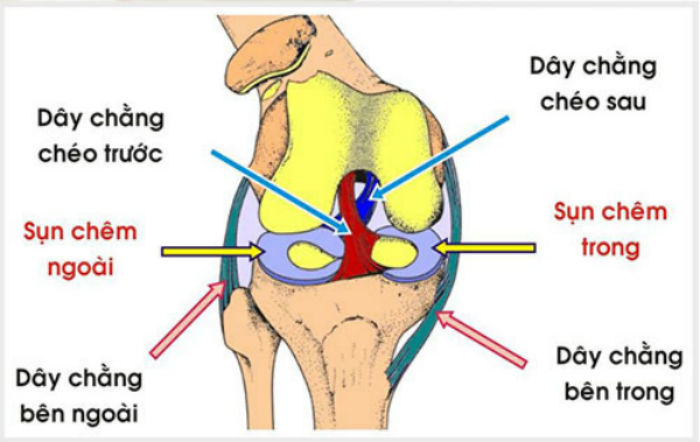 đứt dây chằng,đứt dây chằng chéo trước