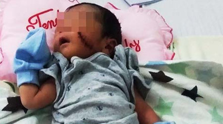 Bé trai bị chôn sống ở Bình Thuận sức khỏe đã ổn định, vẫn chưa có người thân đến nhận