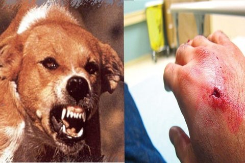 Bệnh dại: Cách phòng ngừa và xử lý vết thương khi bị chó dại cắn