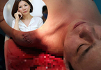 Vụ bác sĩ Chiêm Quốc Thái: Hé lộ thuê giang hồ 1 tỷ đồng trong phòng ngủ