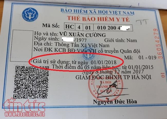 Vì sao thẻ BHYT không ghi ngày hết hạn trên thẻ?