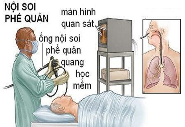 bệnh viện Bạch Mai,nội soi,tai biến