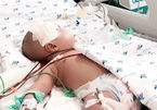 Bị viêm màng não, bé 6 tháng suýt chết vì bị chẩn đoán sốt siêu vi