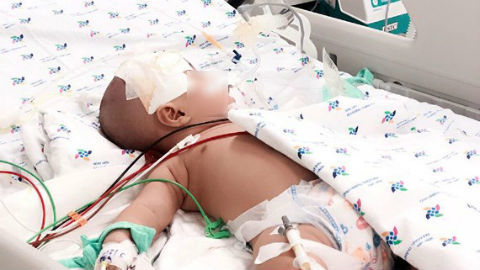 Bị viêm màng não, bé 6 tháng suýt chết vì bị chẩn đoán sốt siêu vi
