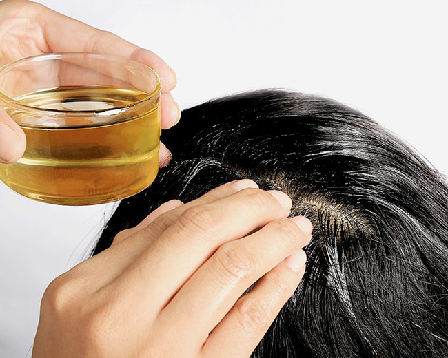 7 cách trị rụng tóc hiệu quả, giúp tóc dày mượt bồng bềnh