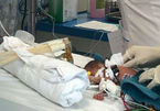 Mổ tại giường cứu sống bé sinh non chỉ to bằng nắm tay bác sĩ
