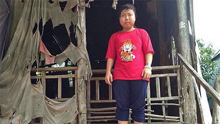 Cha mẹ rời xứ làm thuê không đủ tiền cho con chữa bệnh