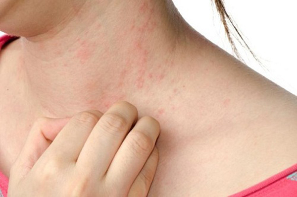 Sự thật phương pháp 'thay máu, lột da' giúp Ngọc Trinh trở nên trắng bóc