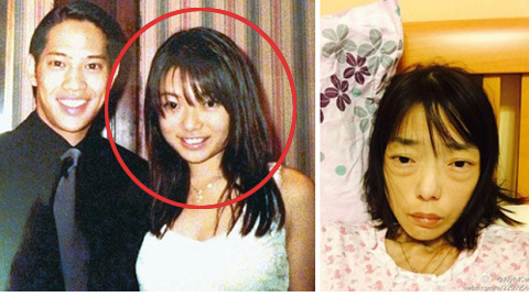 Căn bệnh quái ác khiến sao nữ đình đám già nua như 80 tuổi