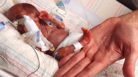 Sinh non nặng vẻn vẹn gần 4 lạng, bé gái sống sót kỳ diệu