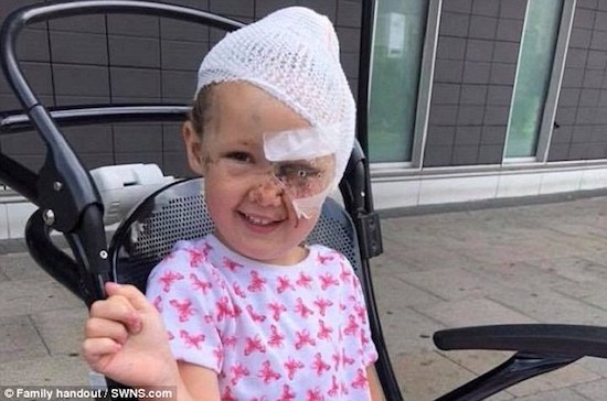 Tillie hoi phuc sau khi bi cho can