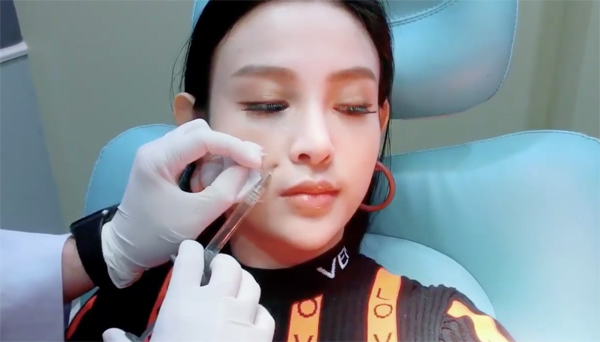 Huyền Baby chia sẻ video tiêm filler xoá mờ nếp nhăn để giữ nhan sắc không tuổi