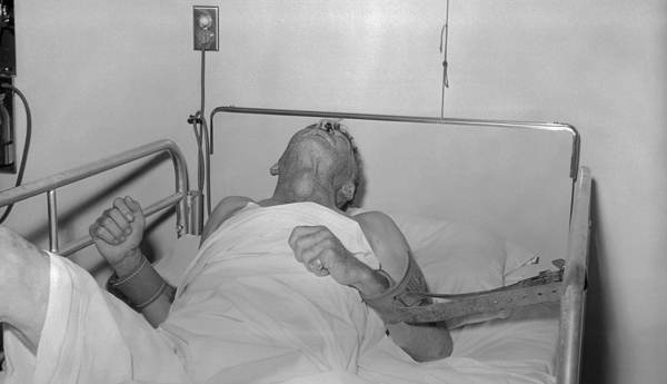 Người đàn ông khoẻ mạnh chết tức tưởi sau 1 tháng do virus dại tấn công