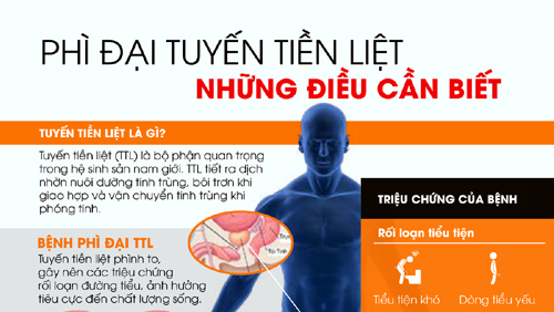 Bạn biết gì về phì đại tuyến tiền liệt?
