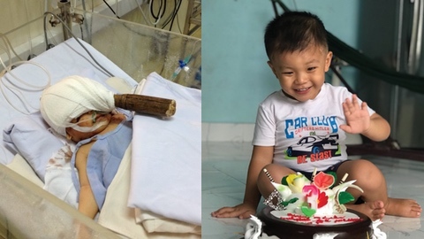 “Cậu bé bị đâm xuyên sọ” cách đây 3 năm giờ ra sao?