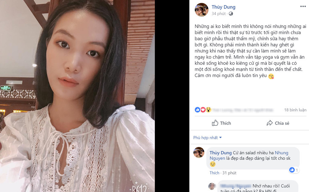 Hoa hậu Thùy Dung khẳng định chưa bao giờ dao kéo
