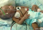 Cậu bé 10 ngày tuổi bị nhiễm trùng máu nặng vì bàn tay vô ý của mẹ