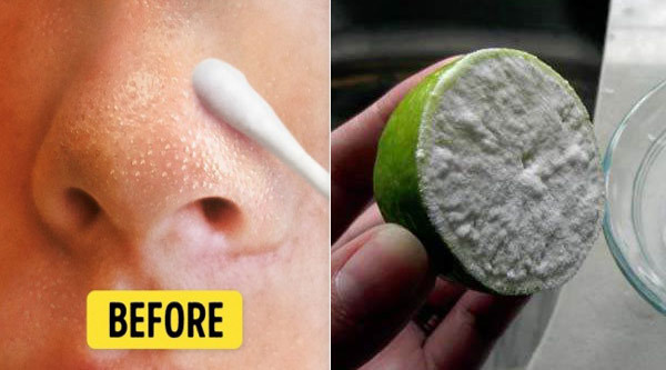 Mẹo đánh bật mụn đầu đen dễ dàng bằng cách chà nửa quả chanh lên mặt