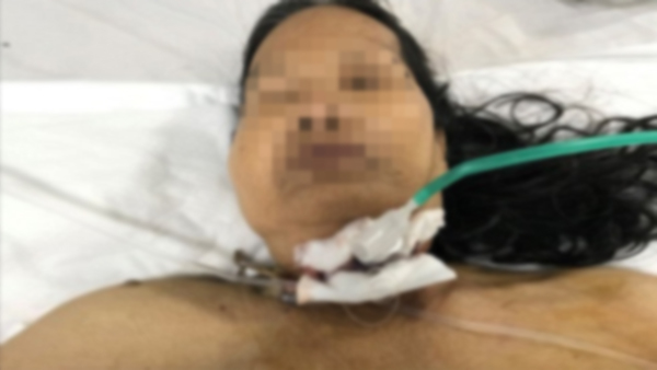 Cháu đang mổ gà, bà nội vô tình ngã vào bị dao đâm xuyên cổ