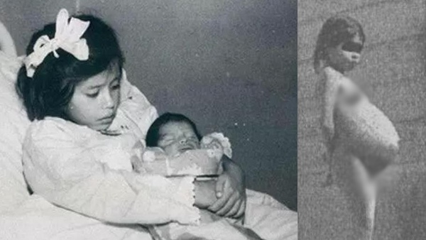 Bí ẩn về ca sinh nở kỳ lạ nhất thế giới, làm mẹ khi 5 tuổi