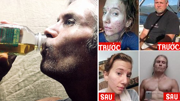 Thực hư việc uống và bôi nước tiểu để giảm cân và trị mụn