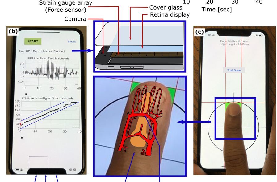 Điện thoại iPhone nào có thể đo huyết áp?
