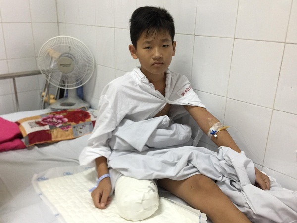 Cậu học trò ung thư và ước mơ lắp chân giả đến trường