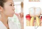 Đánh răng sai cách là nguyên nhân gây ra nhiều bệnh ung thư