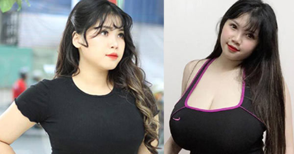 Cô gái Hải Dương khoe ảnh sau phẫu thuật bỏ 2 kg mỡ ngực