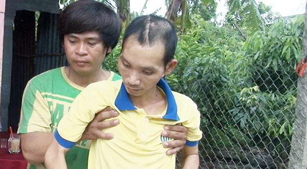 Trong lúc chờ mổ tử thi, người đàn ông bất ngờ sống lại