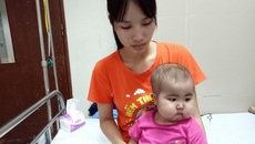 Xót xa bé gái 21 tháng tuổi mắc bệnh hiếm gặp