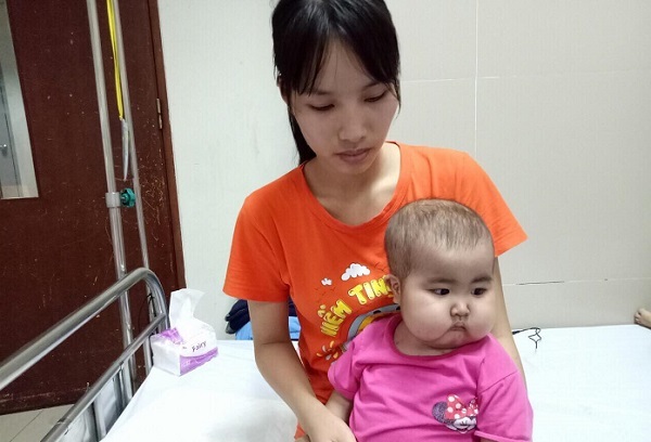 Xót xa bé gái 21 tháng tuổi mắc bệnh hiếm gặp